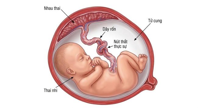 CA SINH HIẾM GẶP - DÂY RỐN THẮT NÚT NHƯNG MẸ TRÒN CON VUÔNG 